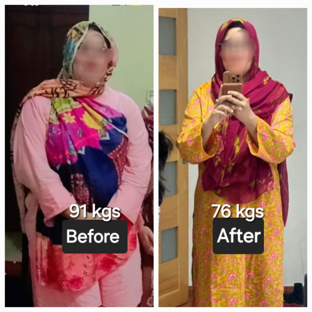 PCOS patient