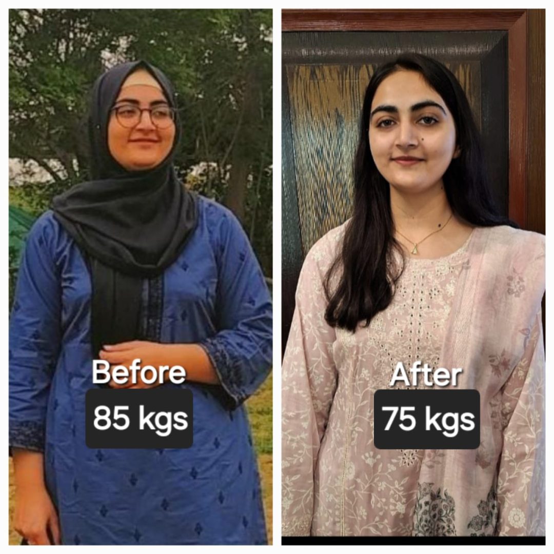 PCOS patient